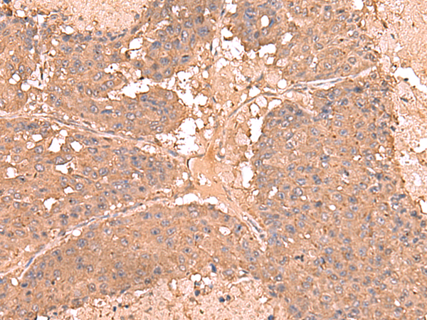 AHCYL1