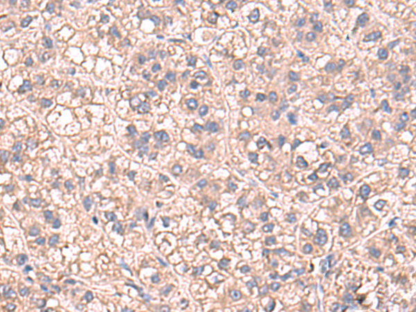 SARS1