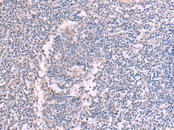 CCT5
