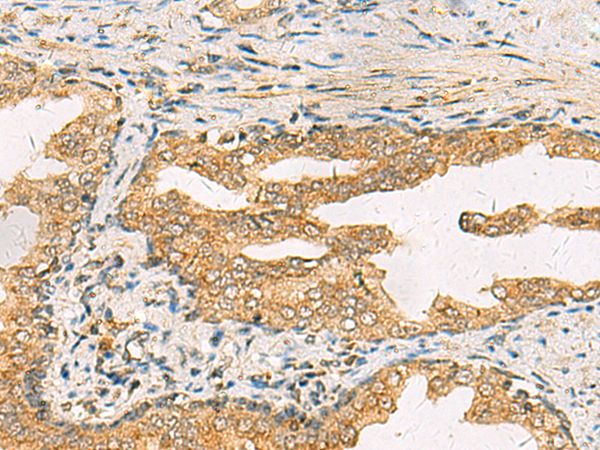 Rabbit Polyclonal Antibody to STX6