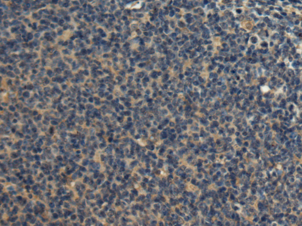 FRG1