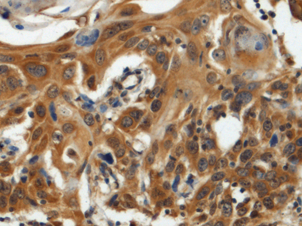 GTPBP2