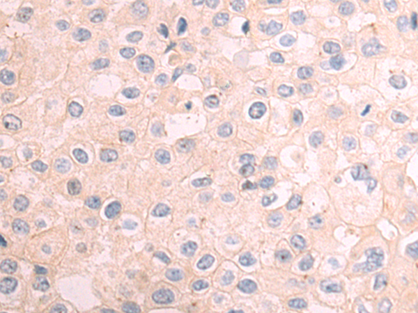 DNAJC11