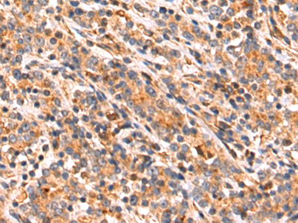 OSGIN2