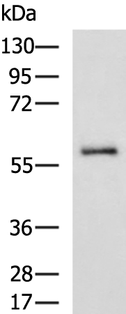 ABHD16A