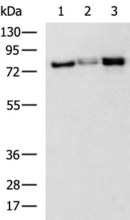 PIK3R1