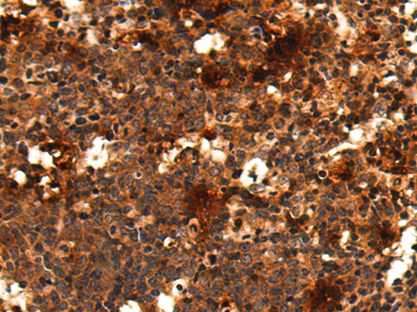 Rabbit Polyclonal Antibody to TSR1