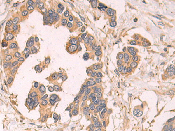 SIMC1
