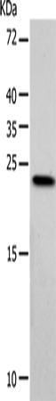 VSNL1