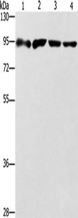 ZBTB10  