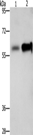 ZBTB7A  