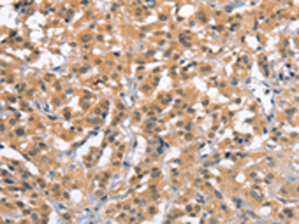 Rabbit Polyclonal Antibody to ZFYVE19  