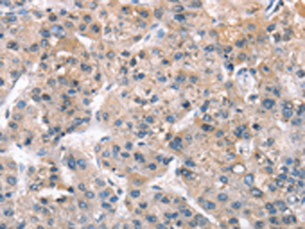 Rabbit Polyclonal Antibody to ZFYVE19  