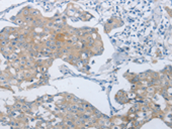 Rabbit Polyclonal Antibody to ABCB9