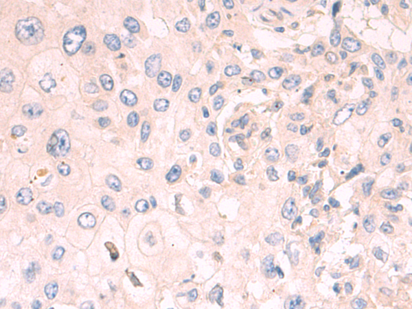 Rabbit Polyclonal Antibody to ABCG2
