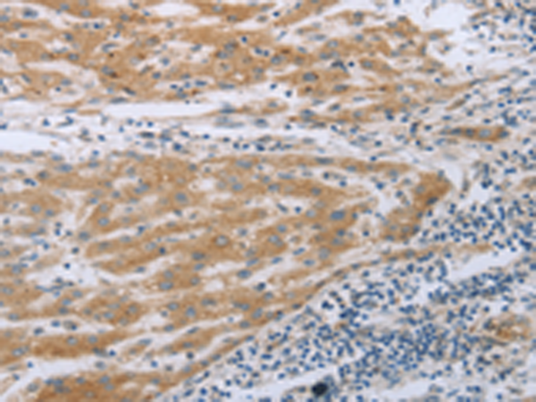 Rabbit Polyclonal Antibody to TNK2