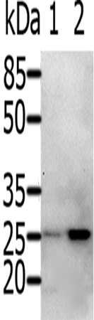 RAB5A