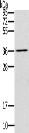 UBXN2A