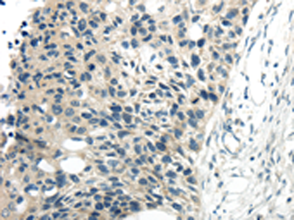 CYP19A1