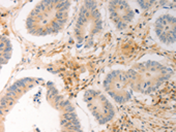 AVPR2