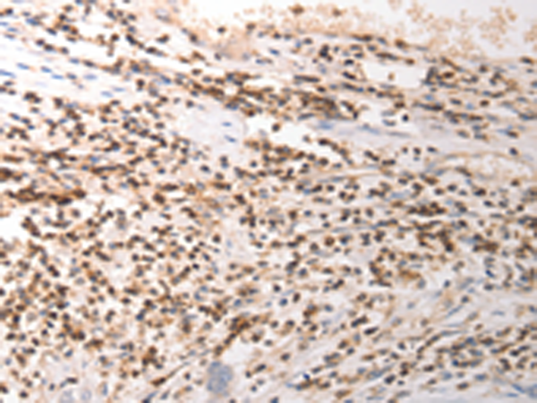VTCN1