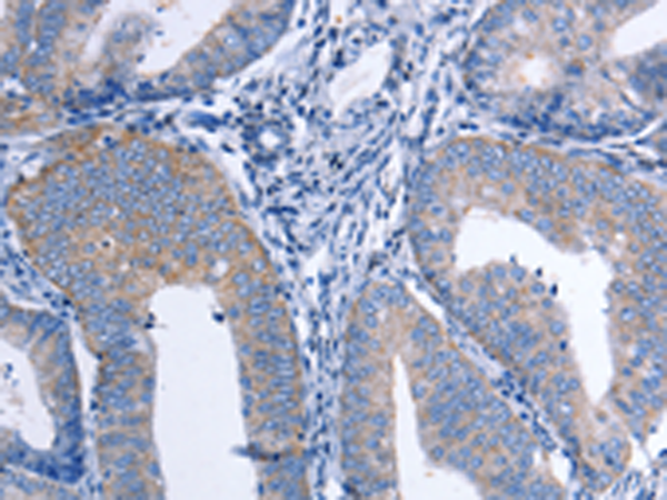 Rabbit Polyclonal Antibody to CCL26