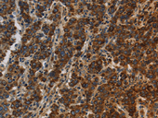 Rabbit Polyclonal Antibody to CCR8