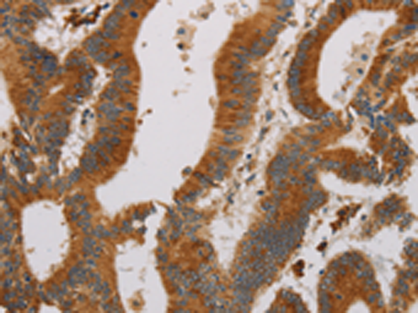 Rabbit Polyclonal Antibody to CCR8
