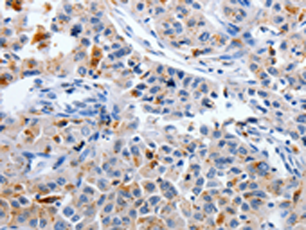 CDK3