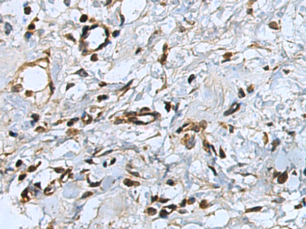 Rabbit Polyclonal Antibody to CEBPD