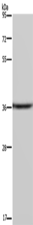CSNK1A1
