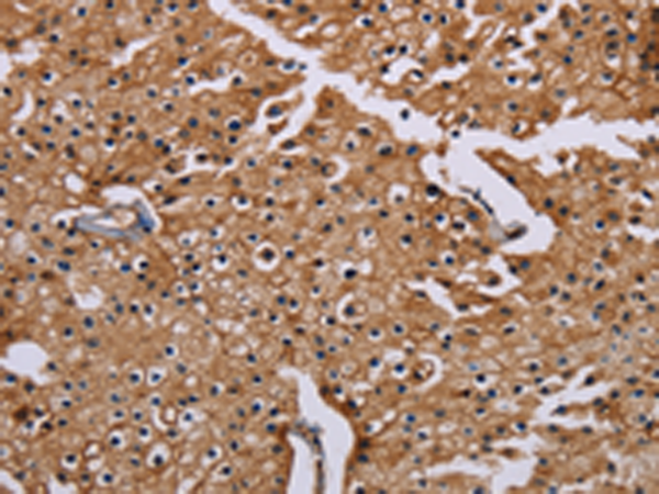 Rabbit Polyclonal Antibody to CSNK1A1