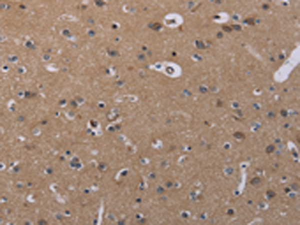 Rabbit Polyclonal Antibody to CSNK1A1