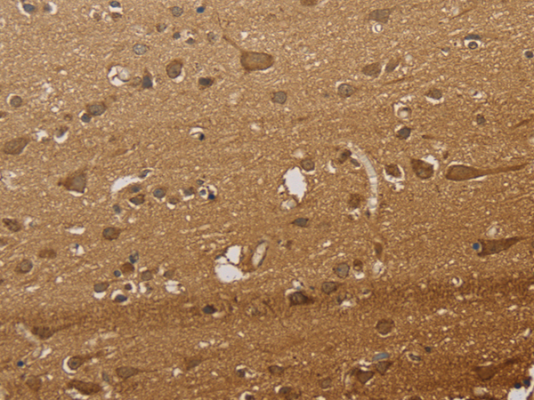 Rabbit Polyclonal Antibody to CSNK2B