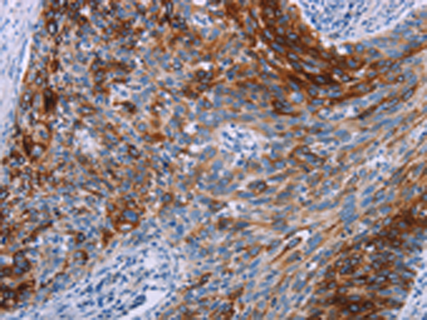 Rabbit Polyclonal Antibody to KRT14
