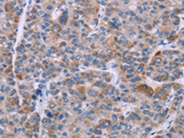Rabbit Polyclonal Antibody to KRT14