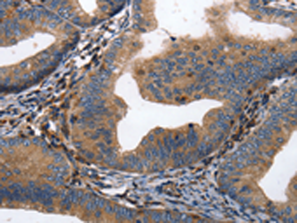 Rabbit Polyclonal Antibody to DPYSL4