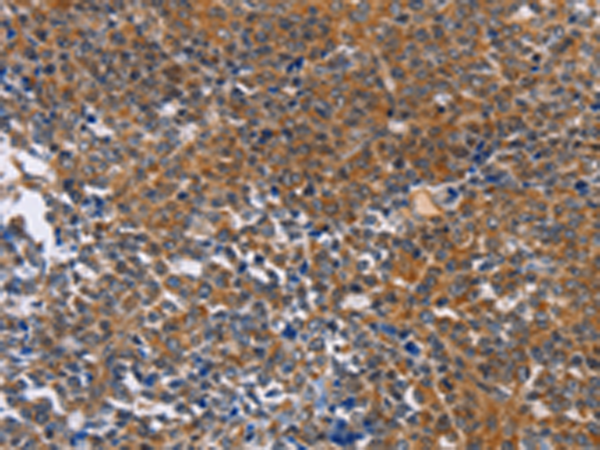 Rabbit Polyclonal Antibody to DPYSL4