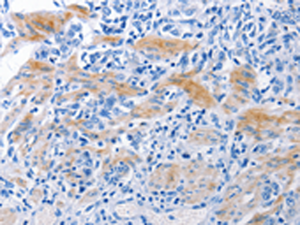 NECTIN1