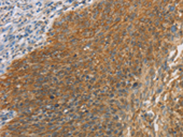 MAPK6