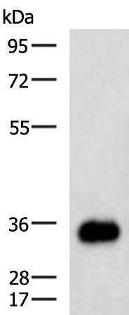 EPCAM