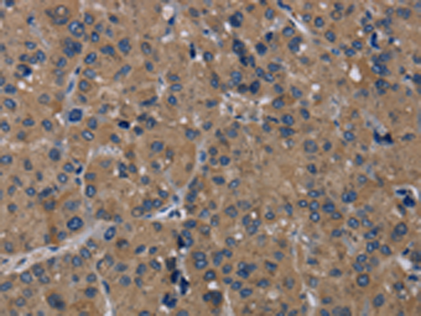 TRPM1