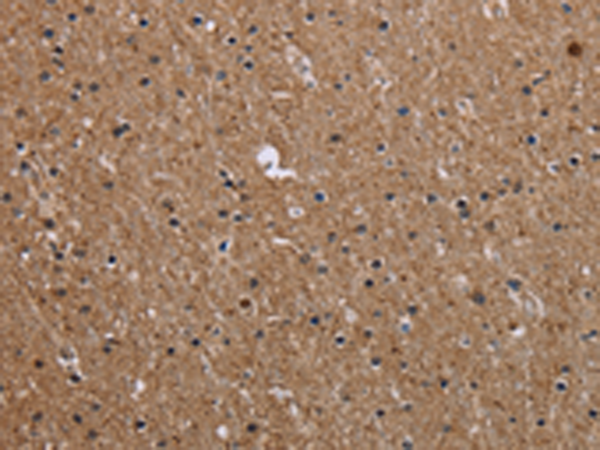 CMTM5