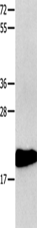 CMTM3