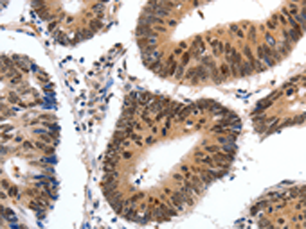 Rabbit Polyclonal Antibody to CMTM3