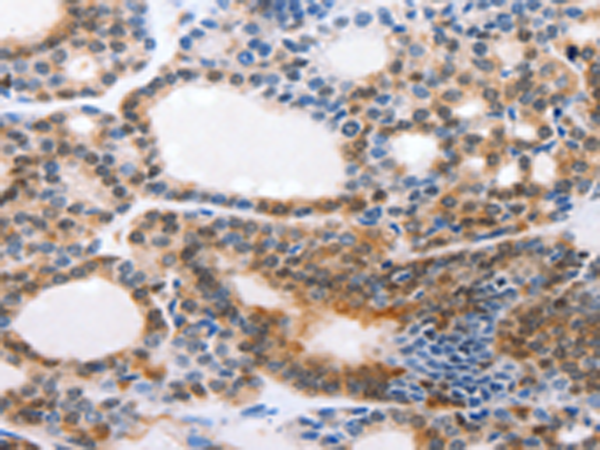 Rabbit Polyclonal Antibody to CMTM3