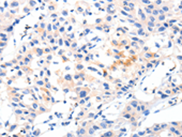 Rabbit Polyclonal Antibody to MSTN