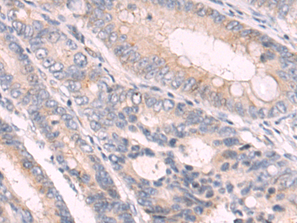 Rabbit Polyclonal Antibody to GFRA3