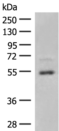 SLC2A3