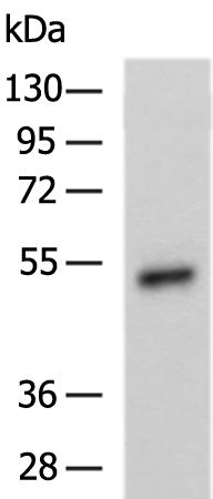 SLC2A12